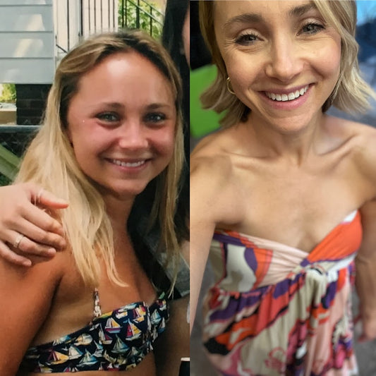 My journey with alcohol
