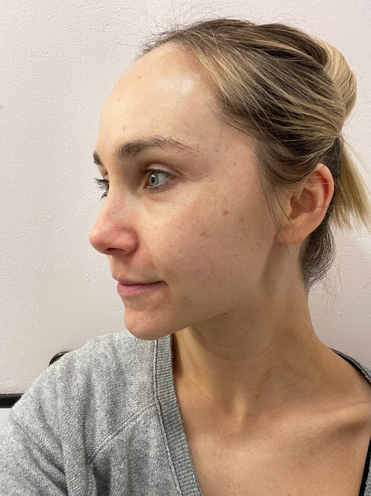 My Skin Journey